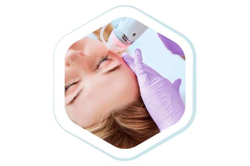 Radio frecuencia Ojeras - ULP
